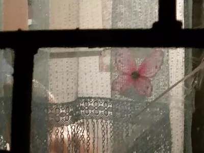 اسے اپنے کندھے پر سنہرے بالوں والی ٹانگیں مل گئیں۔